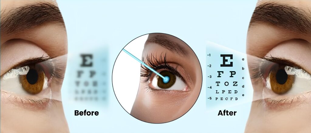 Best Vision Correction in Jabalpur – Laser Eye Treatment at Jan Jyoti